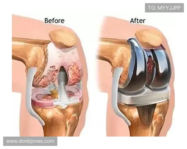 萨尔瓦多带伤复诊：鼻骨骨折伤情追踪